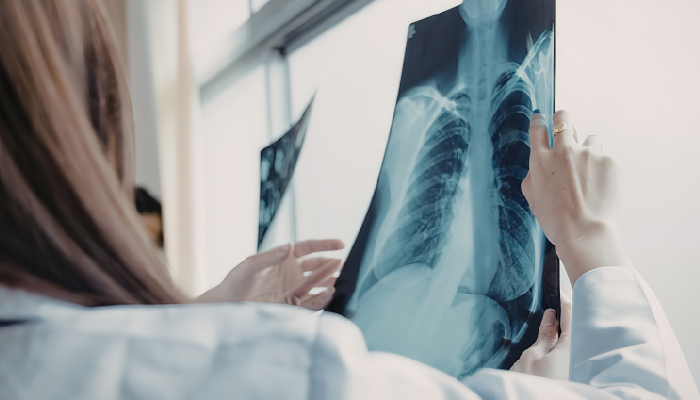 fotos para matéria (70)